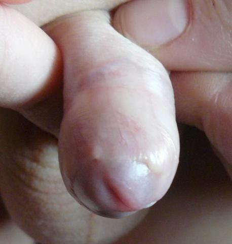 fitymaletapadas